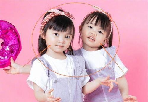 异卵双胞胎明星,揭秘异卵双胞胎明星的璀璨人生  第3张